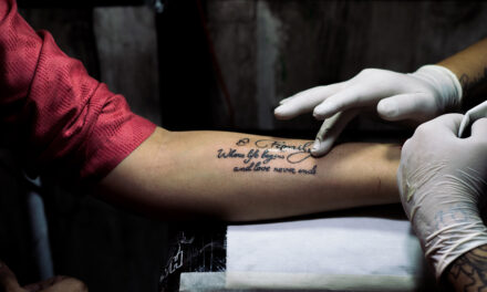 ¿Ya no te gustan tus tatuajes?
