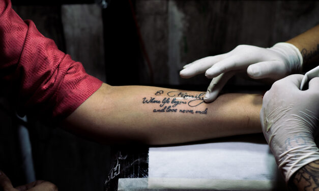 ¿Ya no te gustan tus tatuajes?